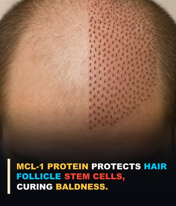 بالوں کی افزائش کے پیچھے سائنس: MCL-1 پروٹین بالوں کی جڑوں کو کیسے مضبوط بناتا ہے