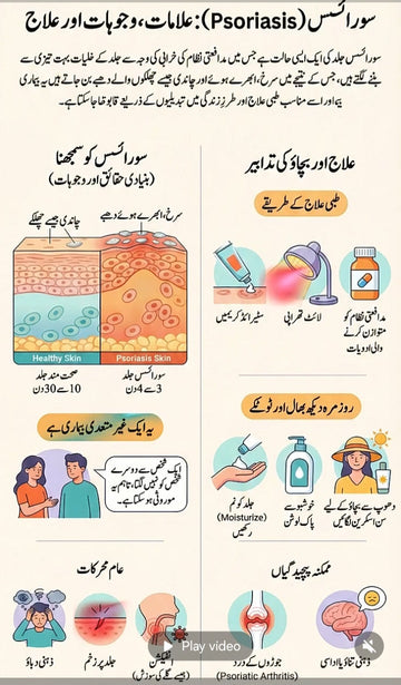 سورائسز (Psoriasis) کیا ہے؟ علامات، وجوہات اور قدرتی علاج